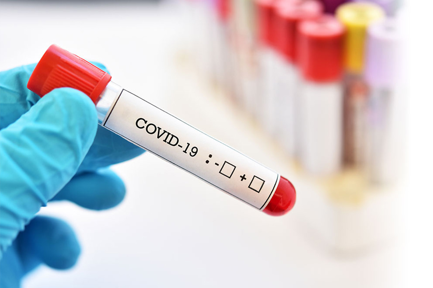 On Assignment and Have Questions About the Coronavirus or COVID-19?